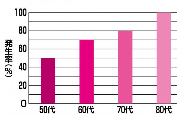 Cataract-chart.jpg