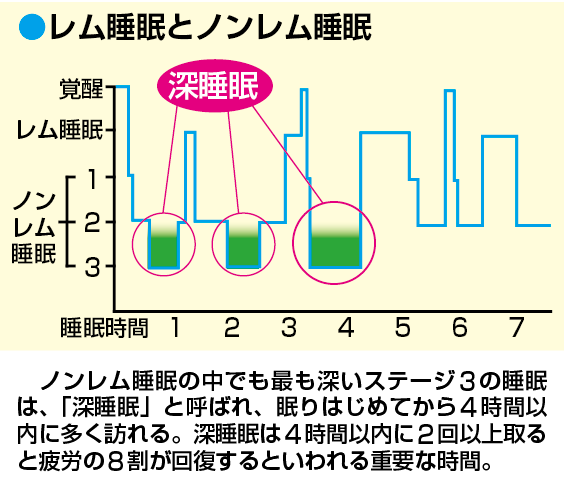 insomnia　Sleep graph.png