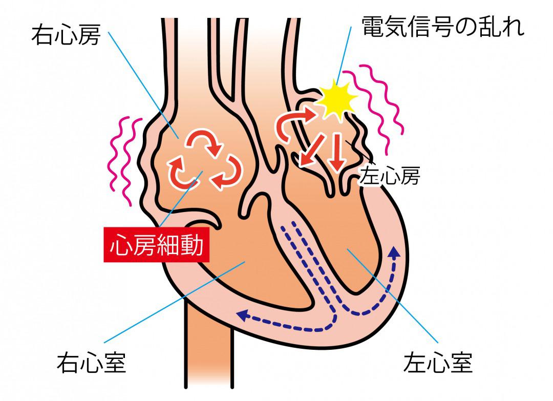 心房 細 動 の 名医