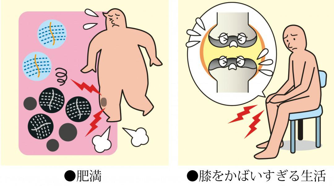 s_膝　プロ　減少　原因.jpg