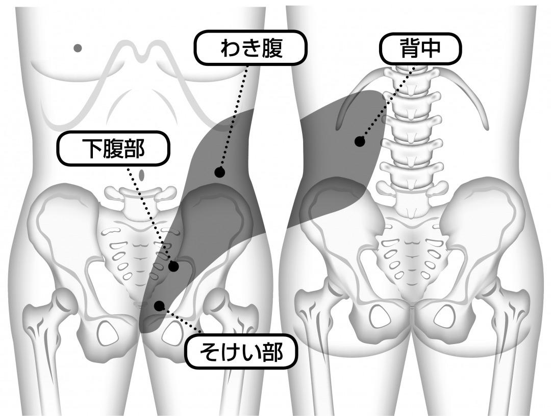 s_結石部位.jpg