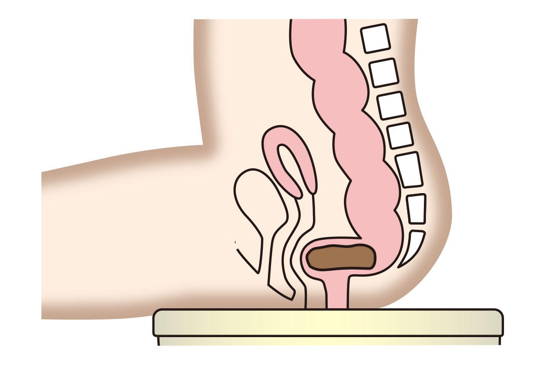 お尻上げ排便_引き上げ1.jpg