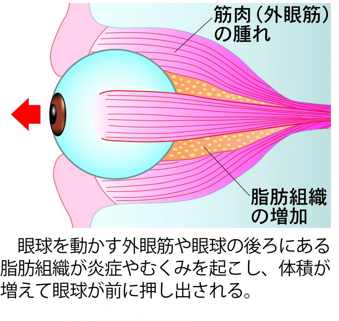 眼球-1.jpg