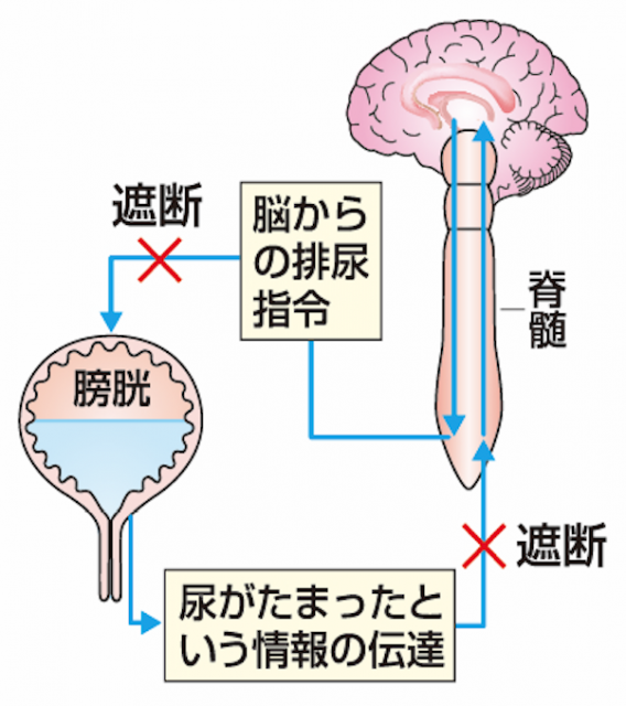 s_スクリーンショット 2018-03-05 14.56.47 (1).png