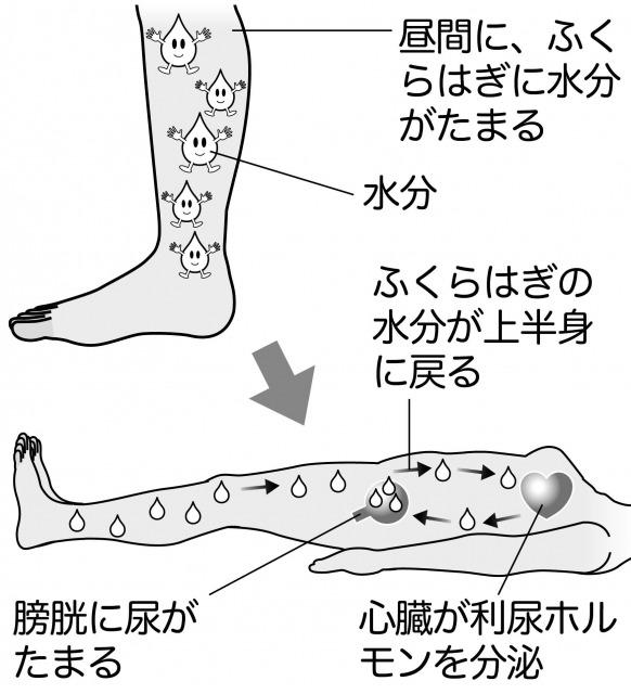 Nocturia.jpg