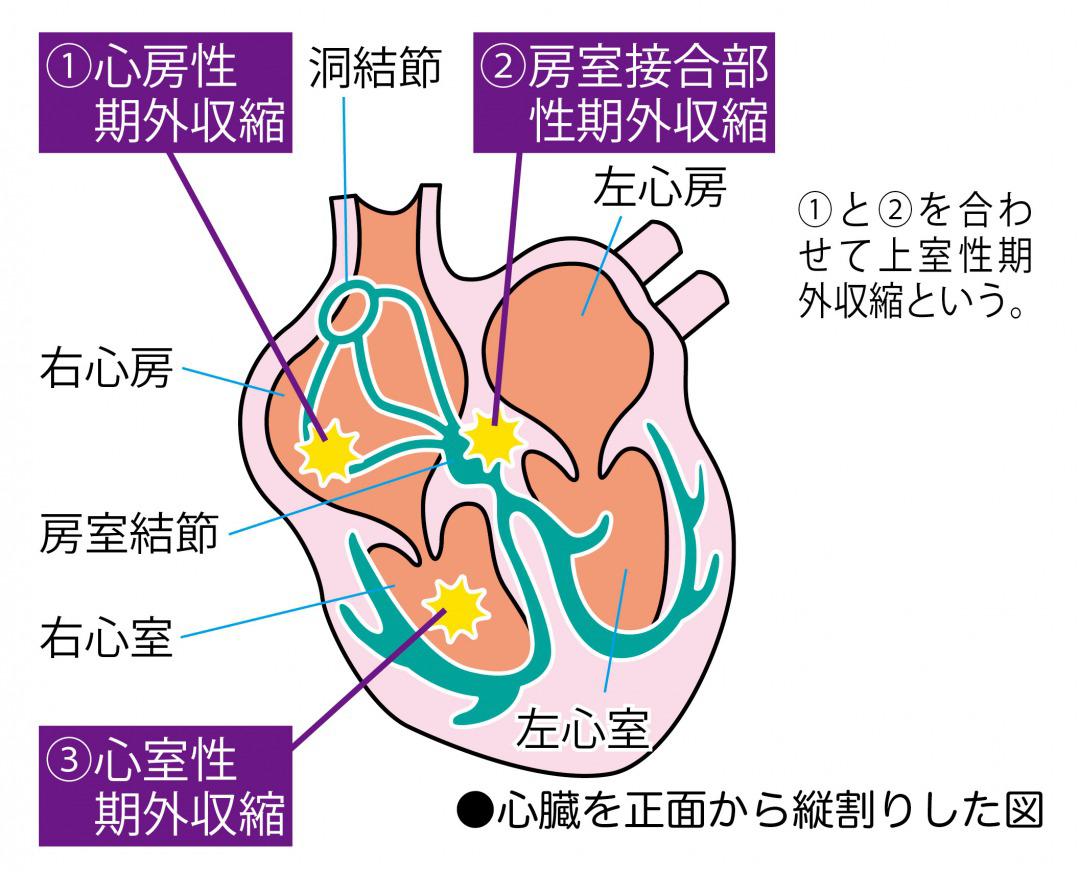 期 外 収縮 デパス 効果