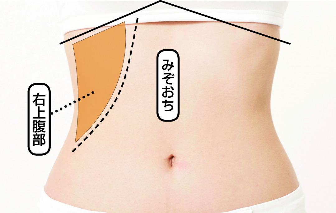 みぞおち から 下 腹部 の 痛み