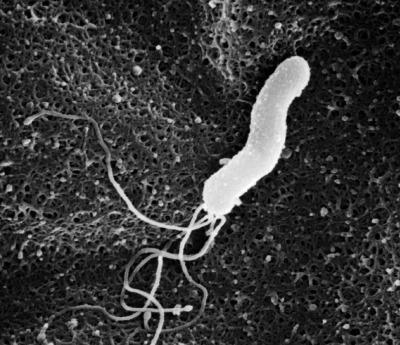s_Helicobacter pylori.jpg