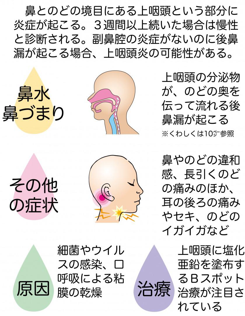 chronic-on-pharyngitis-chart.jpg