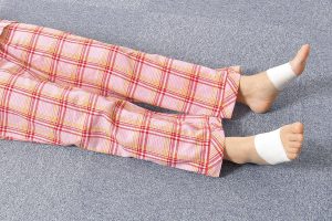 下肢静脈瘤のセルフ対策【足の甲テーピング】で足のむくみ・痛み・かゆみが改善