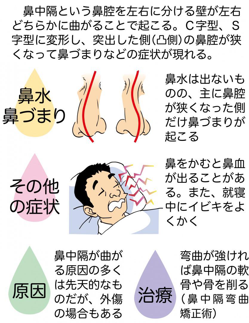 deviation-of-the-nasal-septum-chart.jpg