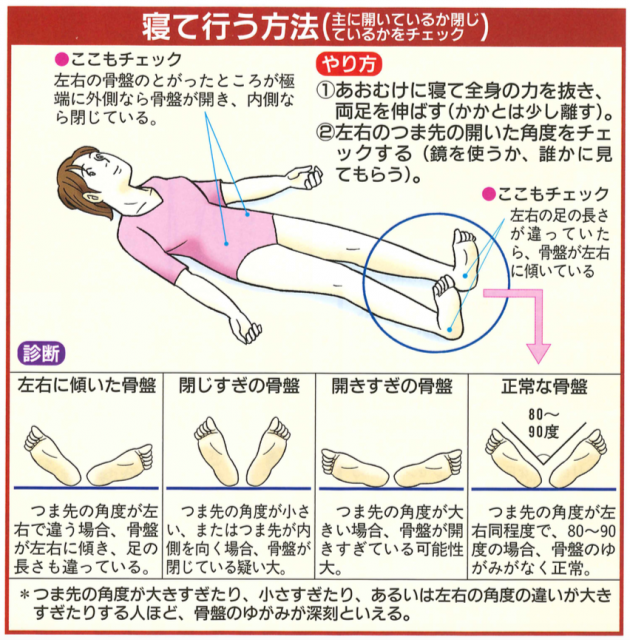 骨盤のゆがみの自己チェック法 を医師が徹底解説 ゆがみの有無 ゆがみ方 重症度がすぐにわかる カラダネ