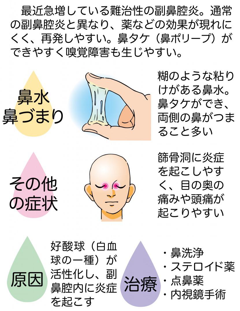 eosinophilic-sinusitis-chart.jpg