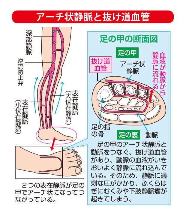 アーチ状静脈と抜け道血管2.jpg