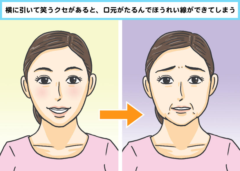 顔には 若顔筋 と 老顔筋 があるって知ってる 老け見えの原因は知らぬ間に老け顔筋を酷使しているから 老け顔グセ直し カラダネ