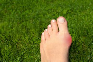 【専門医解説】外反母趾・足裏痛は「竹踏み」で自力対策！足裏強化で治そう