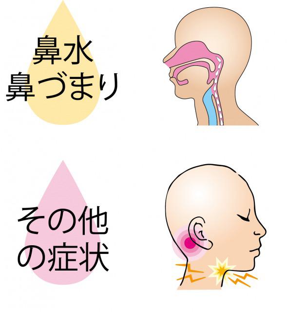 s_Symptoms of sinusitis3.jpg