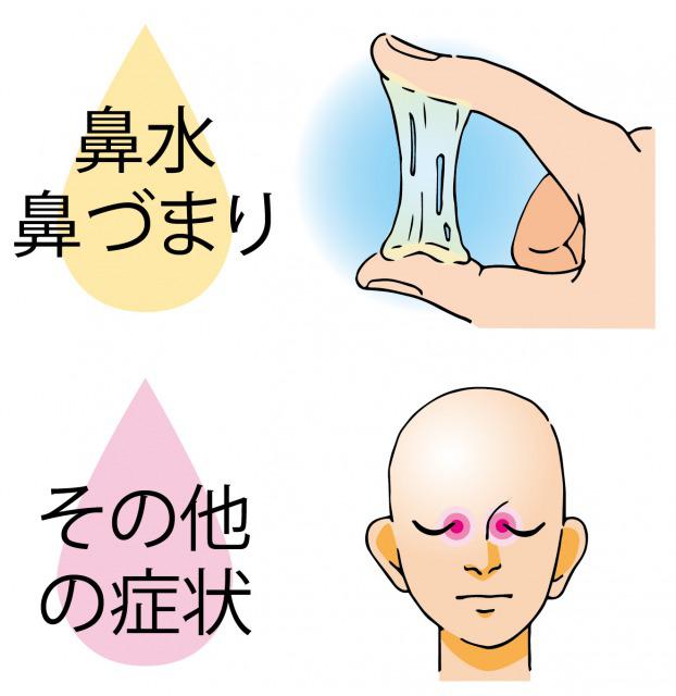 s_Symptoms of sinusitis5.jpg