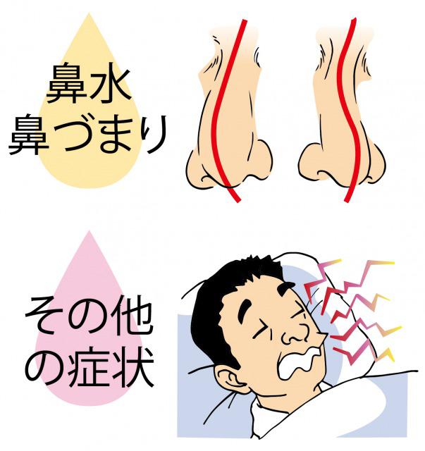 s_Symptoms of sinusitis7.jpg