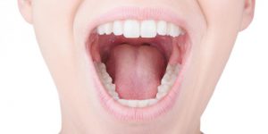 【口内フローラにご用心】100億の細菌がすむ口内フローラの乱れは歯周病・虫歯ばかりか全身病まで招く