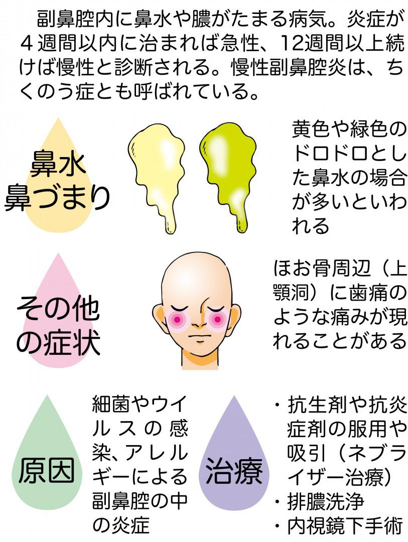 sinusitis-chart.jpg